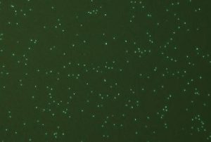 average-somatic-cell-count-in-dairy-cows