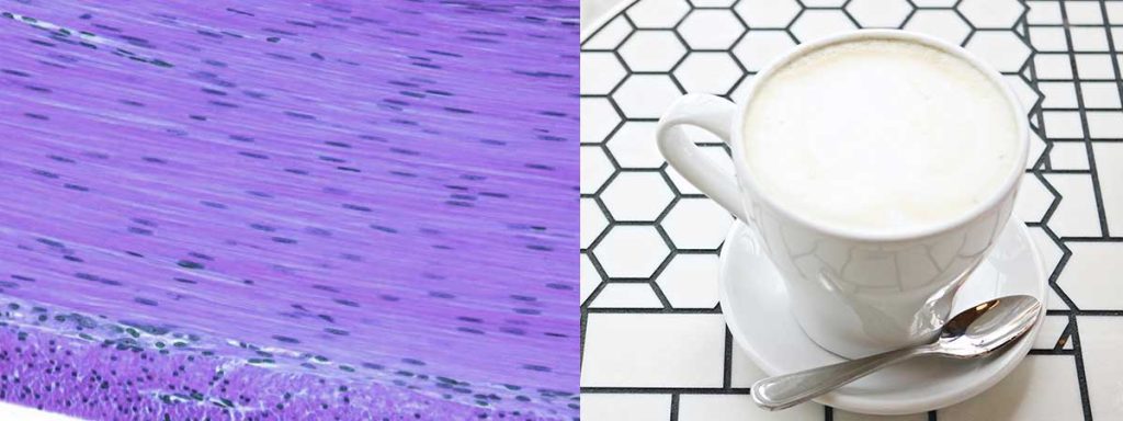 cause-of-high-somatic-cell-count-in-milk