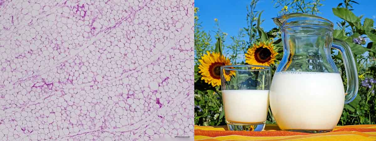 How Differential Somatic Cell Count Stacks Up Against Total Somatic