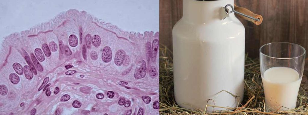 direct-microscopic-somatic-cell-count