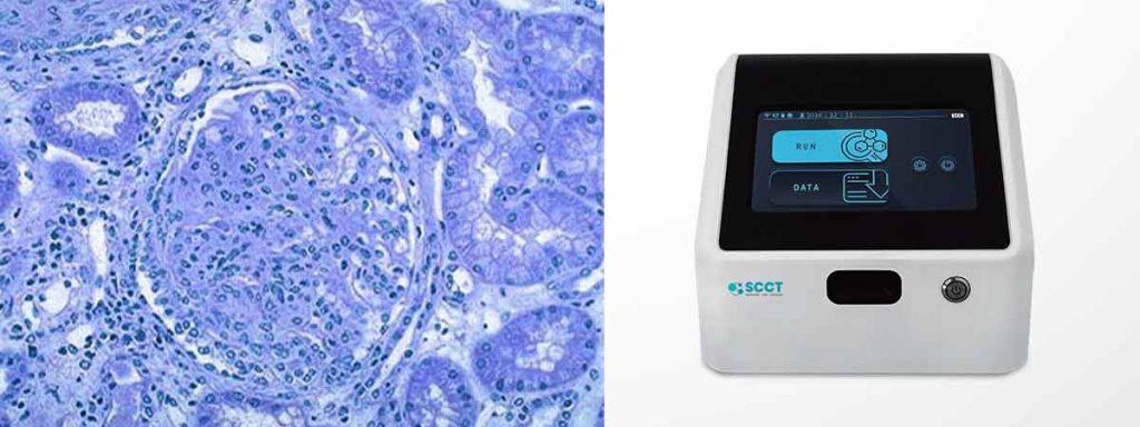 high-somatic-cell-count-in-dairy-cows