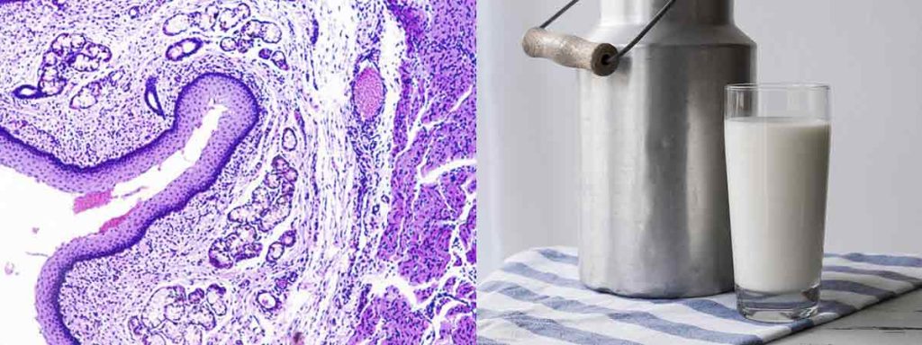 how-to-calculate-somatic-cell-count-in-milk