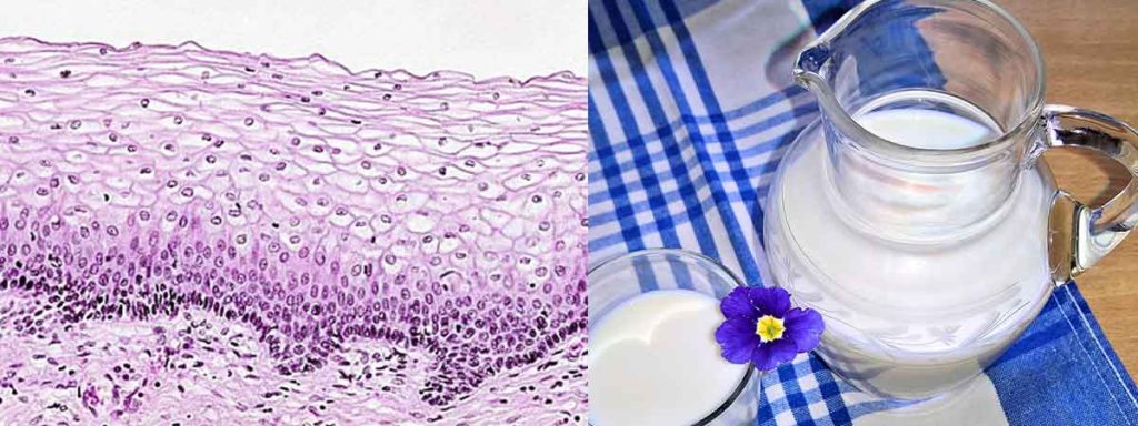 microscopic-somatic-cell-count