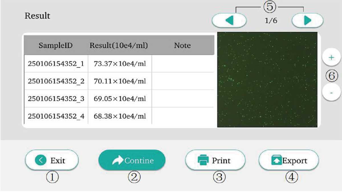 somatic-cell-count-in-dairy-cattle