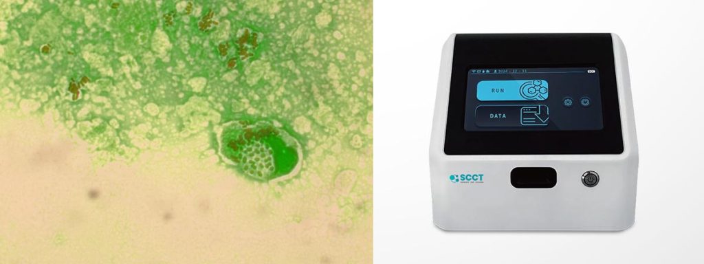 clinical-mastitis-somatic-cell-count