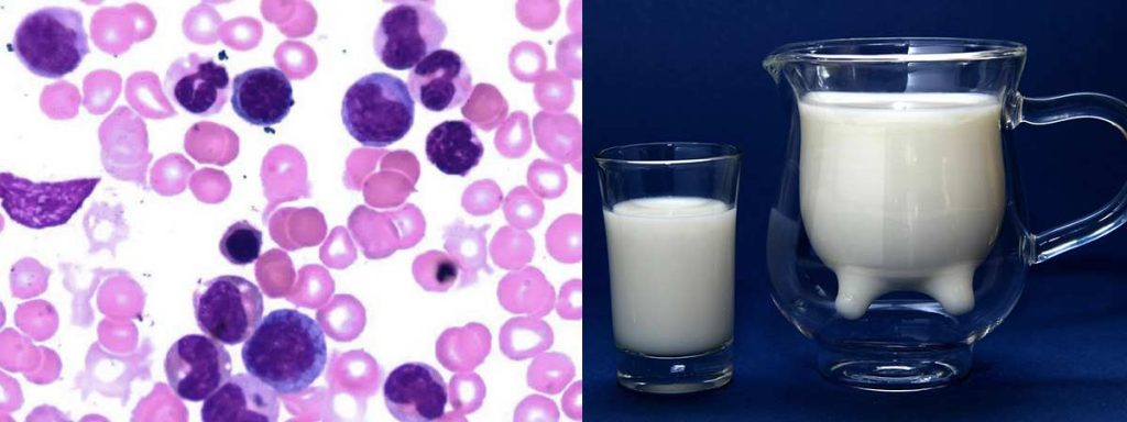effect-of-somatic-cell-count-on-milk-quality
