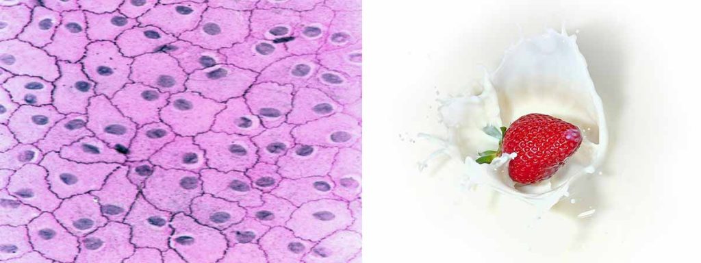 elevated-somatic-cell-counts-in-dairy-cows