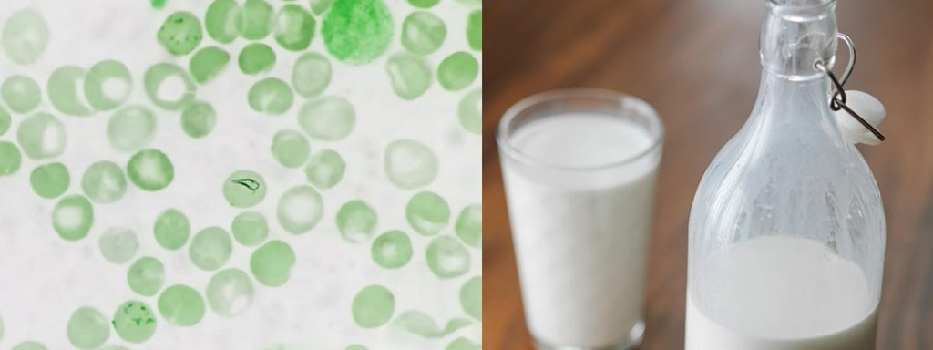 somatic-cell-count-milk-quality