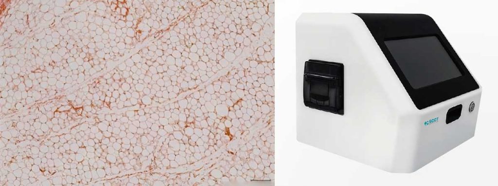 definition-of-somatic-cell-count