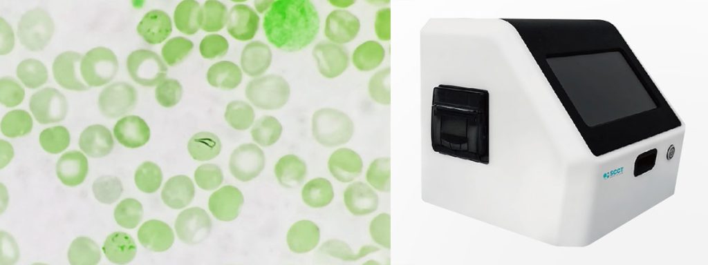 effects-of-high-somatic-cell-count-in-milk