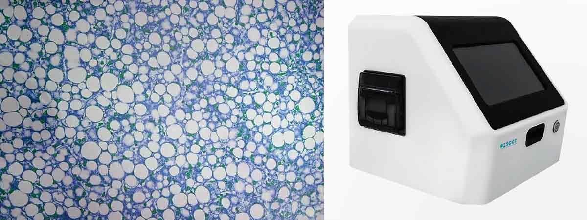 How We Ensure Accuracy Through the Technology Behind Somatic Cell ...