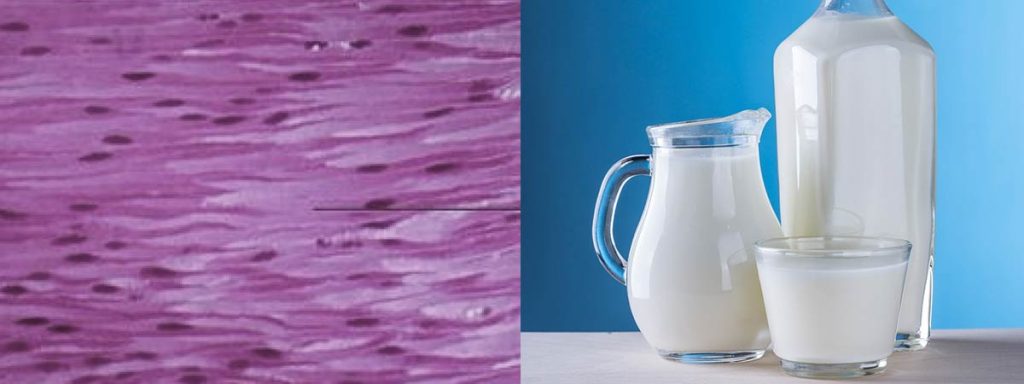 high-somatic-cell-counts