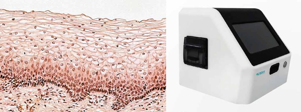 how-are-somatic-cell-counts-in-milk-performed