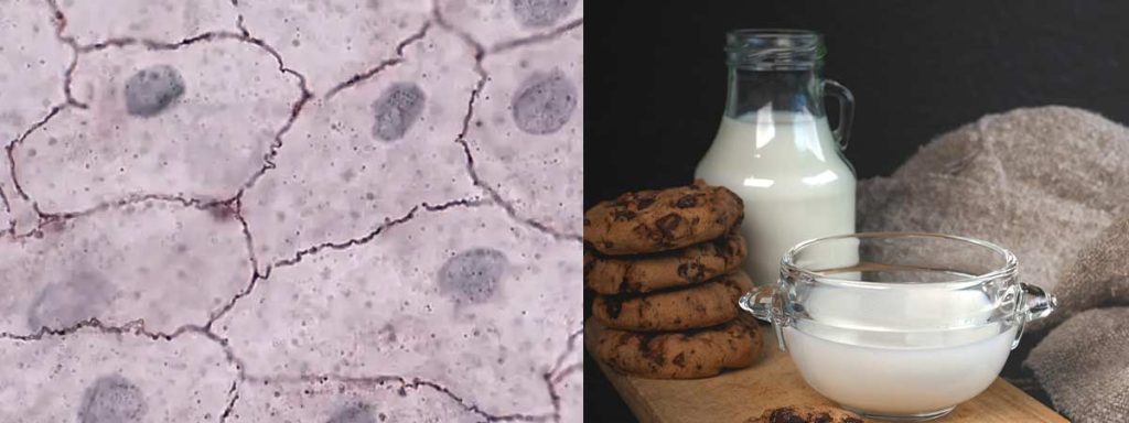 somatic-cell-counting