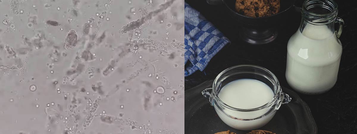 10 Must Know Facts About Somatic Cell Count Scct