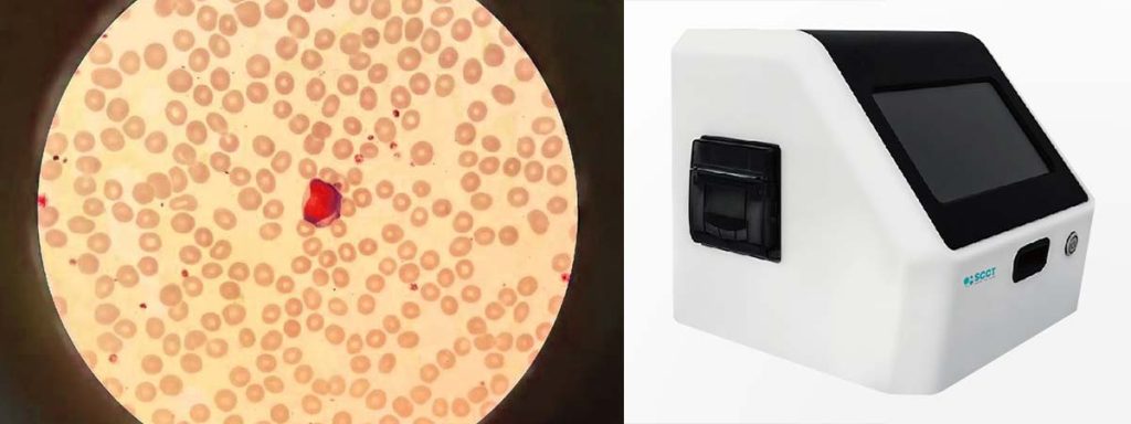 what-is-somatic-cell-count-in-milk