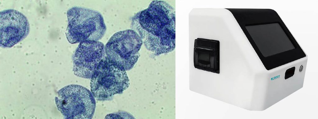 somatic-cell-count-in-milk-test​