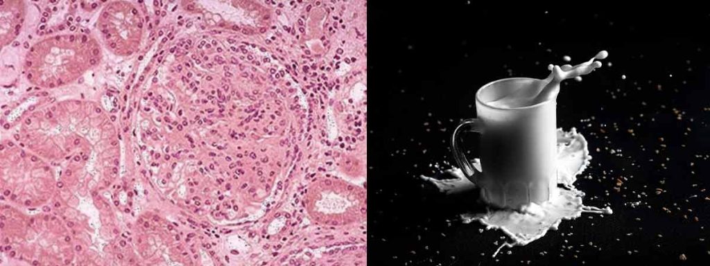 somatic-cell-count-linear-score-calculation