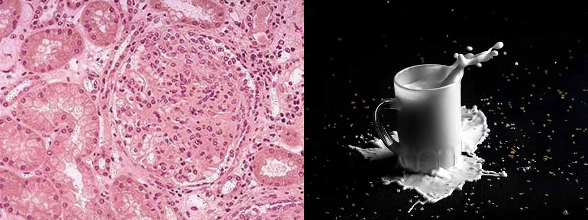 Simplifying Somatic Cell Count Evaluation With The Linear Score Method