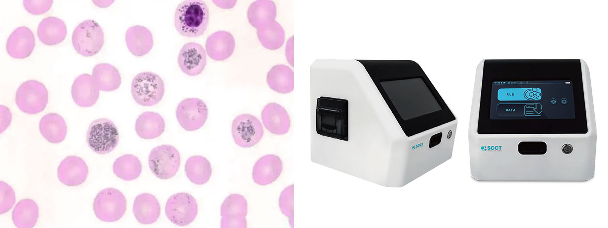Cell Count Assay Machine Leveraging Historical Data for Smarter Somatic Cell Count Risk ...