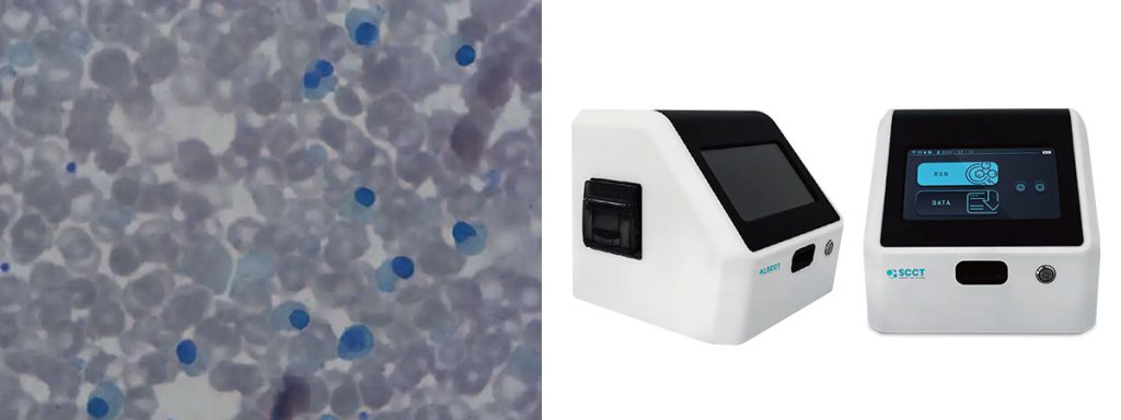 somatic-cell-counts-to-improve-milk-quality