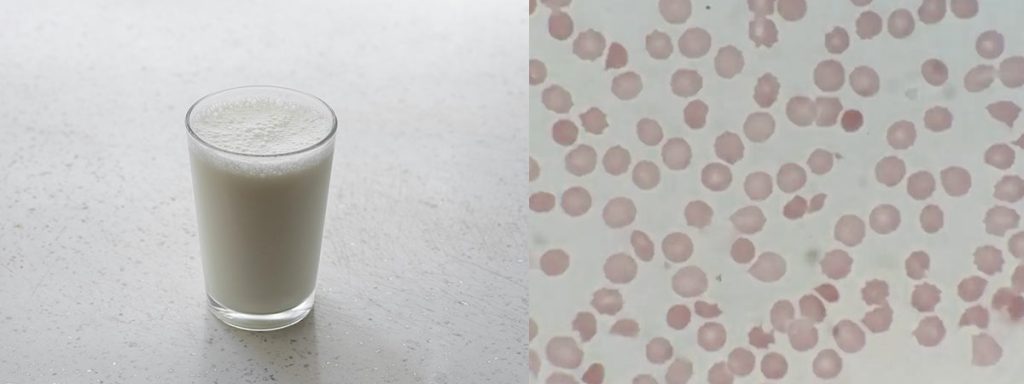 digital-somatic-cell-counter