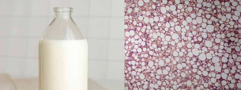 is-somatic-cell-count-a-test