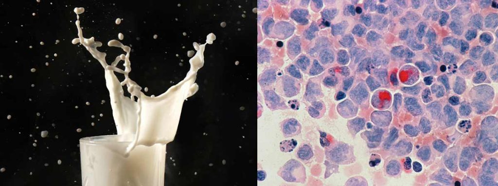 somatic-cell-count-california-mastitis-test