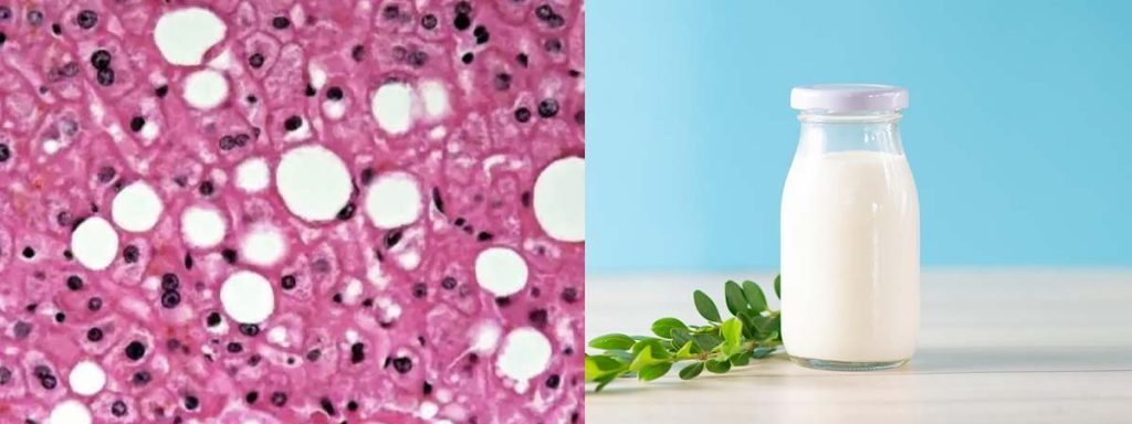 somatic-cell-score-vs-somatic-cell-count