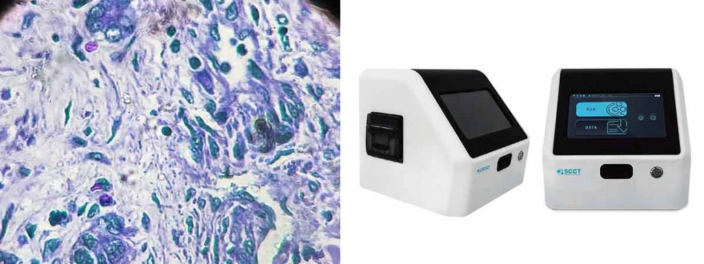 somatic-cells-count-in-milk