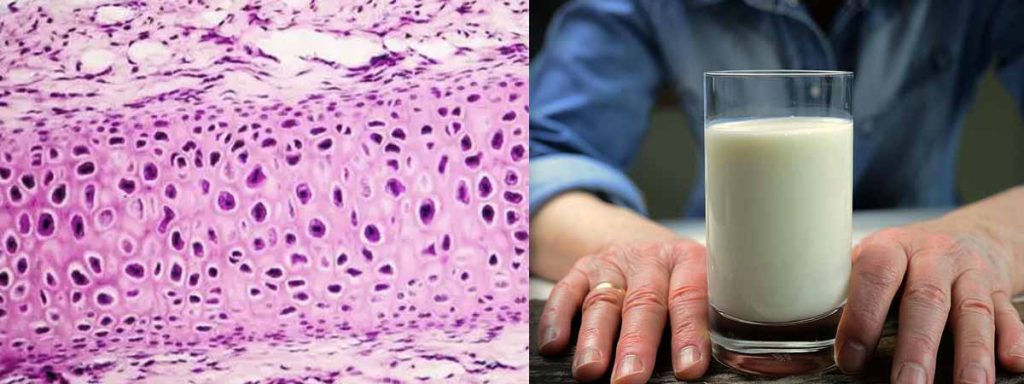 what-affects-somatic-cell-count