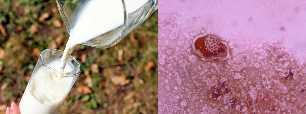 what-does-somatic-cell-count-mean