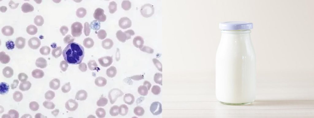 what-does-somatic-cell-count-measure