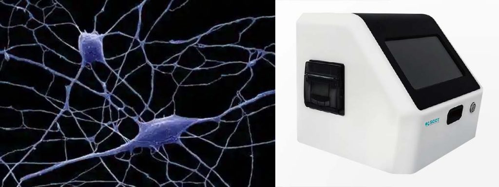 define-somatic-cell-count