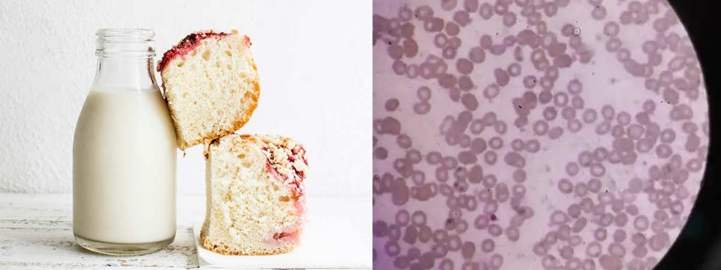 somatic-cell-picture