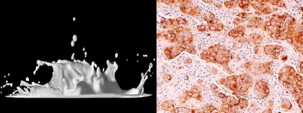 what-is-somatic-cell-count-score