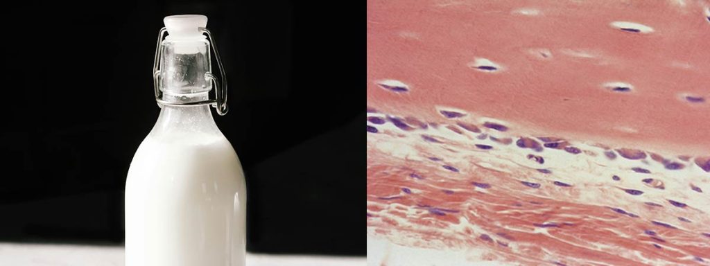 what-is-somatic-cell-count-test