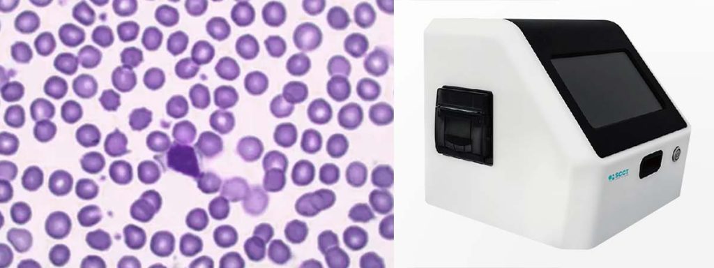 why-is-somatic-cell-count-important