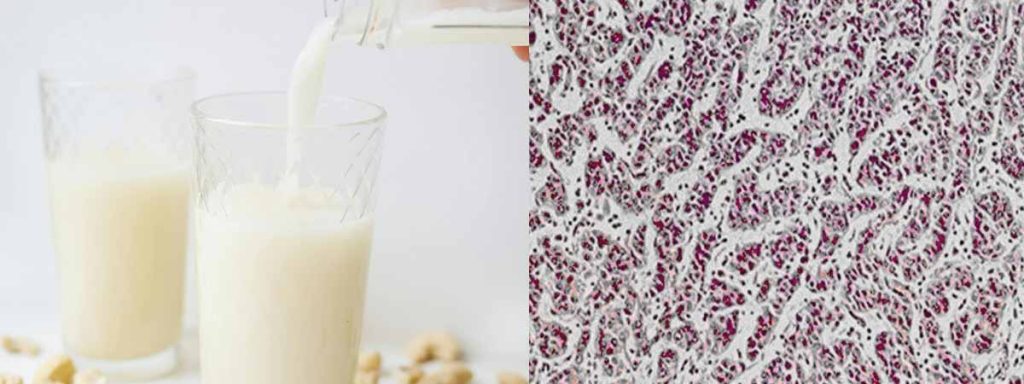 definition-for-somatic-cell