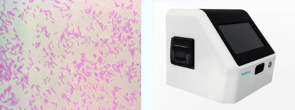 e-coli-mastitis-in-cows-treatment