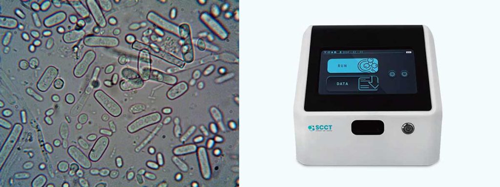 klebsiella-infection