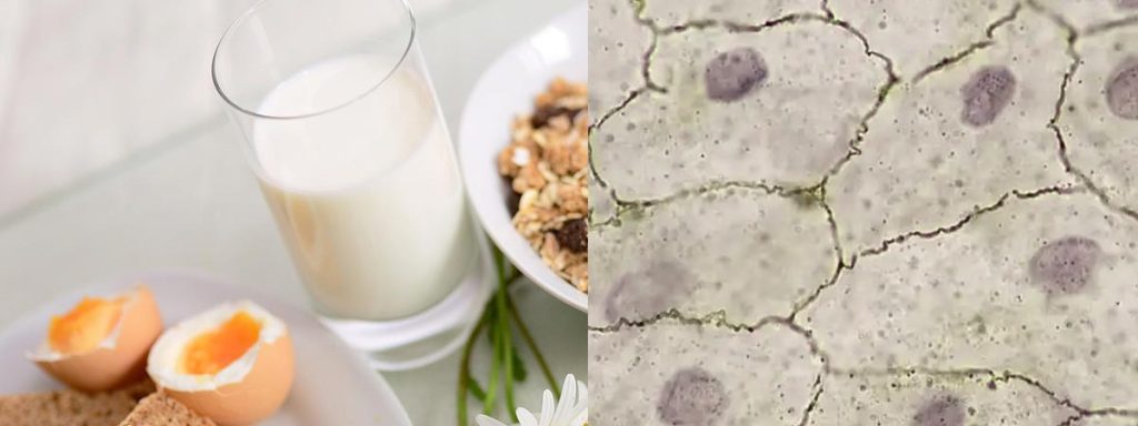 bulk-tank-somatic-cell-counts​