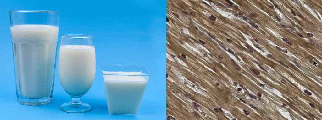 how-to-lower-scc-in-dairy-cows