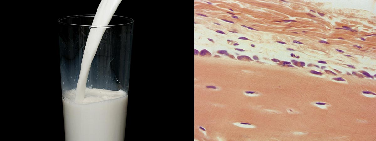 Decoding the Effects of Metabolic Imbalances on Somatic Cell Count in ...