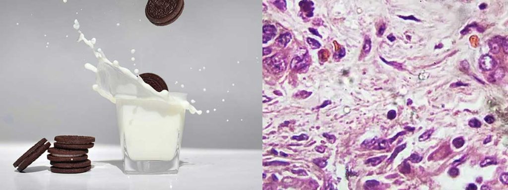 somatic-cells-in-milk-cows