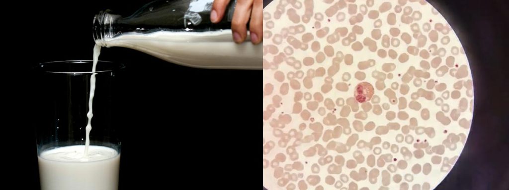 what-does-somatic-mean