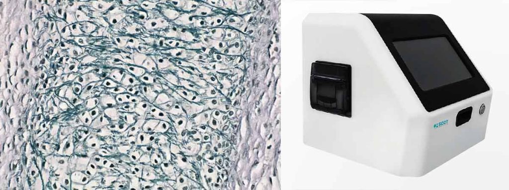 amount-of-somatic-cells-allowed-in-milk