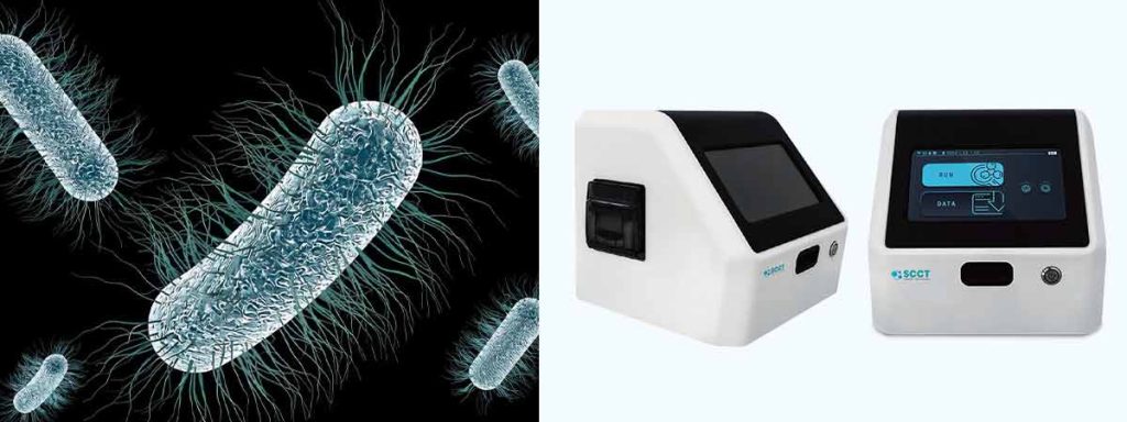 an-optimum-transformation-for-somatic-cell-concentration-in-milk