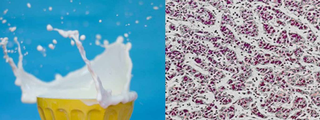 california-mastitis-test-results