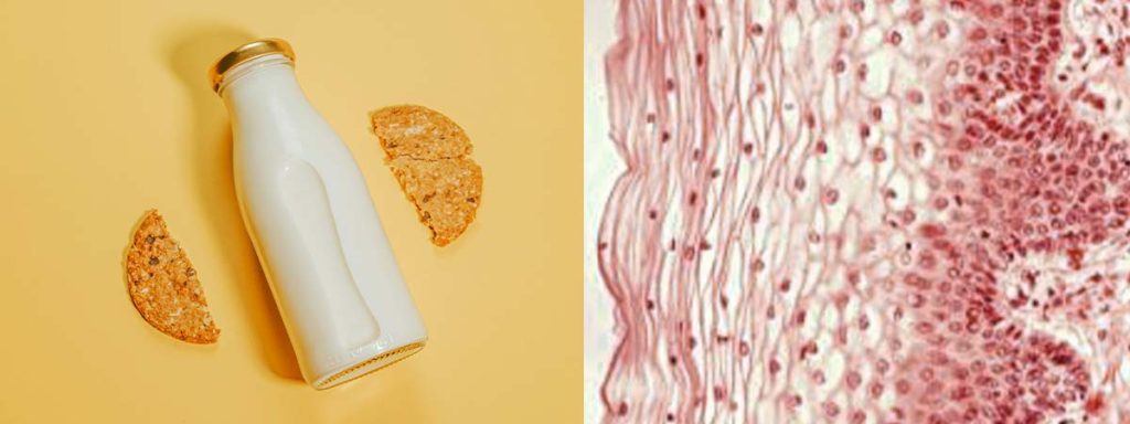 somatic-cells-allowed-in-milk